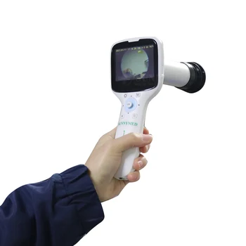 SY-V042N Yeni tıbbi cihaz kolay kullanım gözler taşınabilir fundus kamera